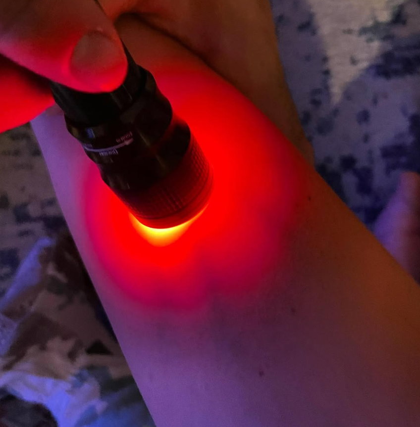Customer photo, Illumivein® glowing on the forearm