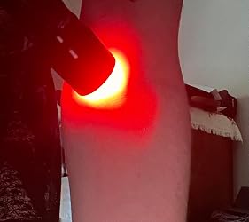 Customer photo, Illumivein® pressed to the arm